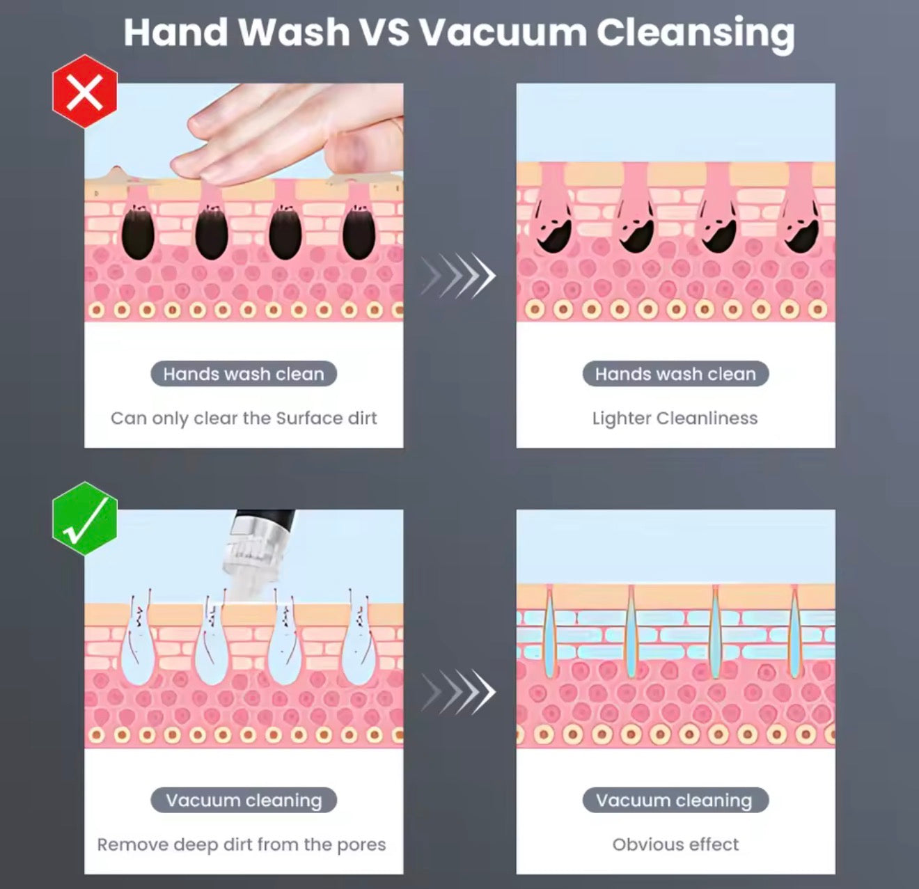 Máquina de hidrodermoabrasión 3 en 1,