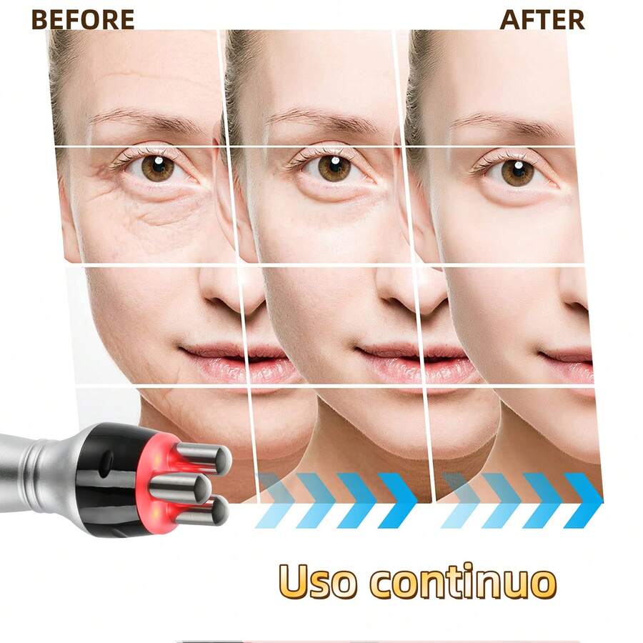 Máquina de belleza
