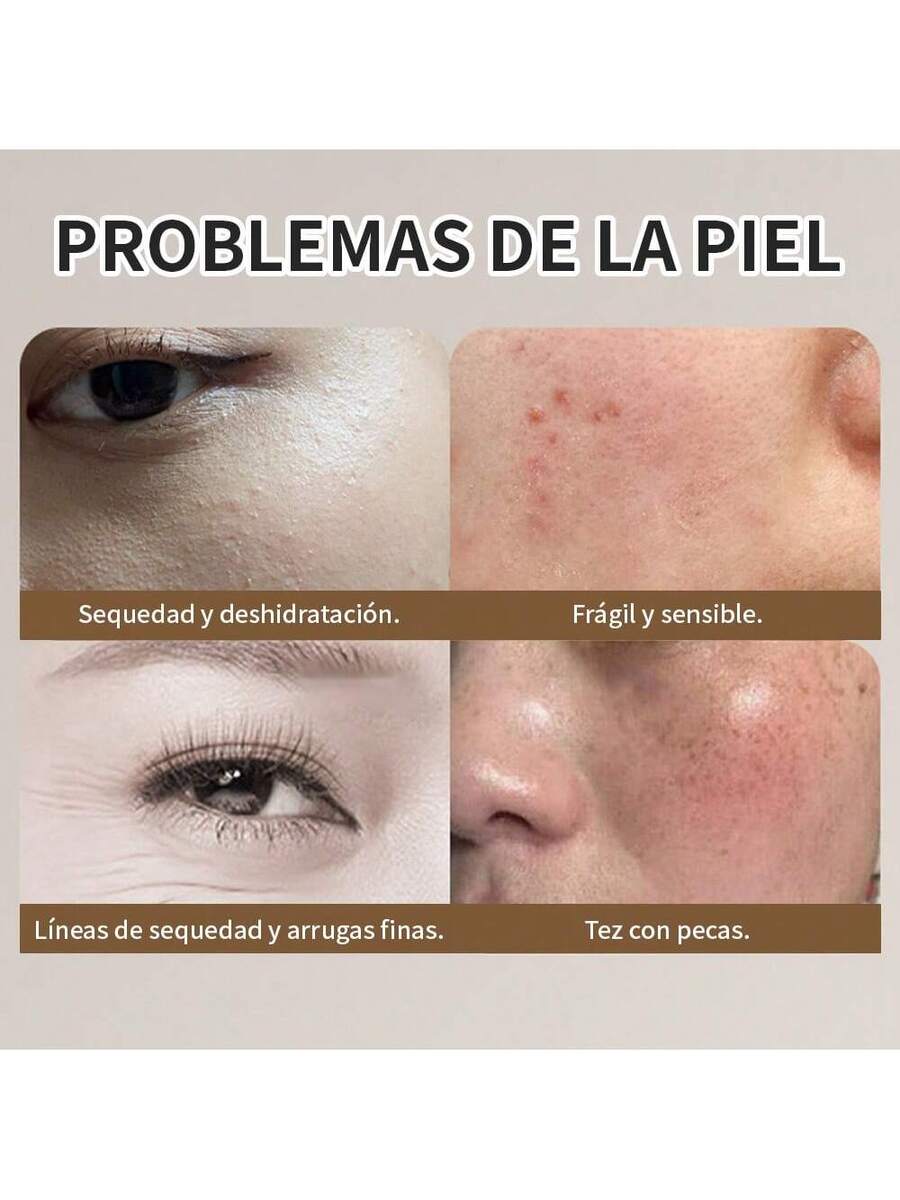 Analizador de aceite de humedad de la piel con Pantalla inteligente