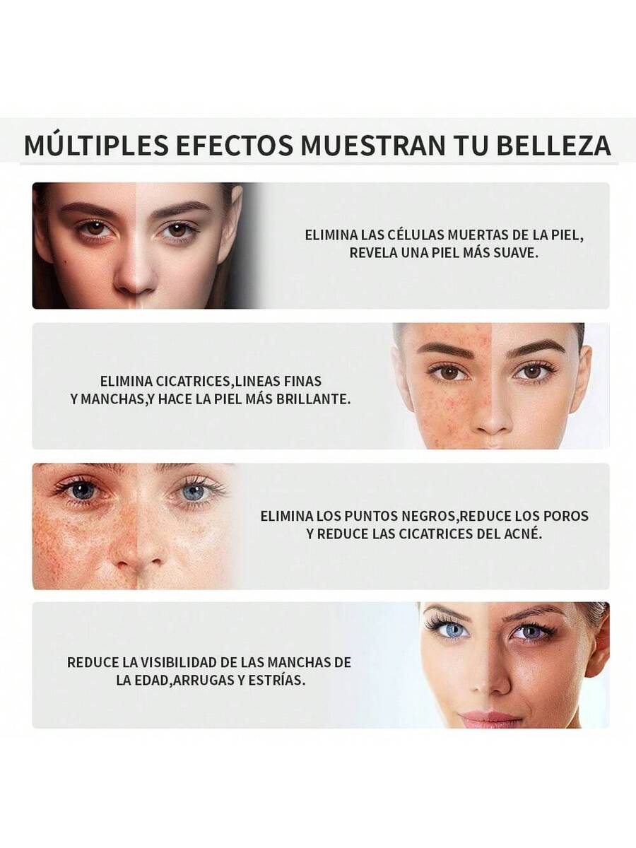 Máquina profesional Microdermoabrasión 3 En 1