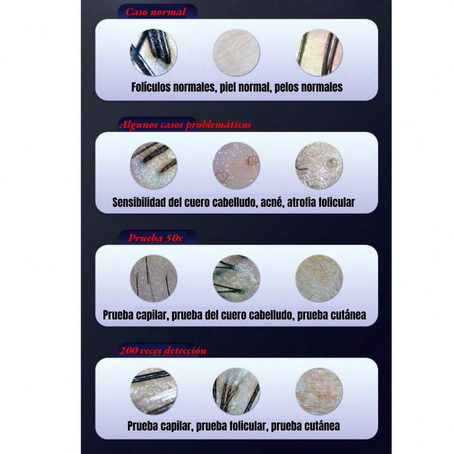 Detector De Folículos De Piel Y Cabello