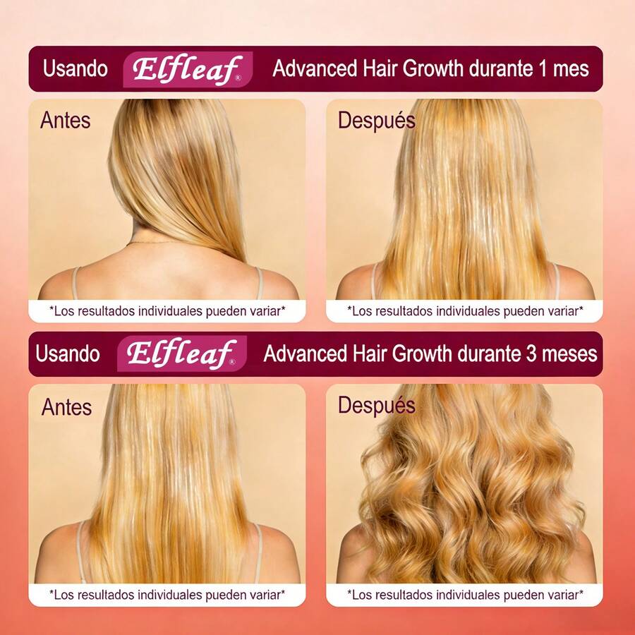 Vitaminas Crecimiento Del Cabello
