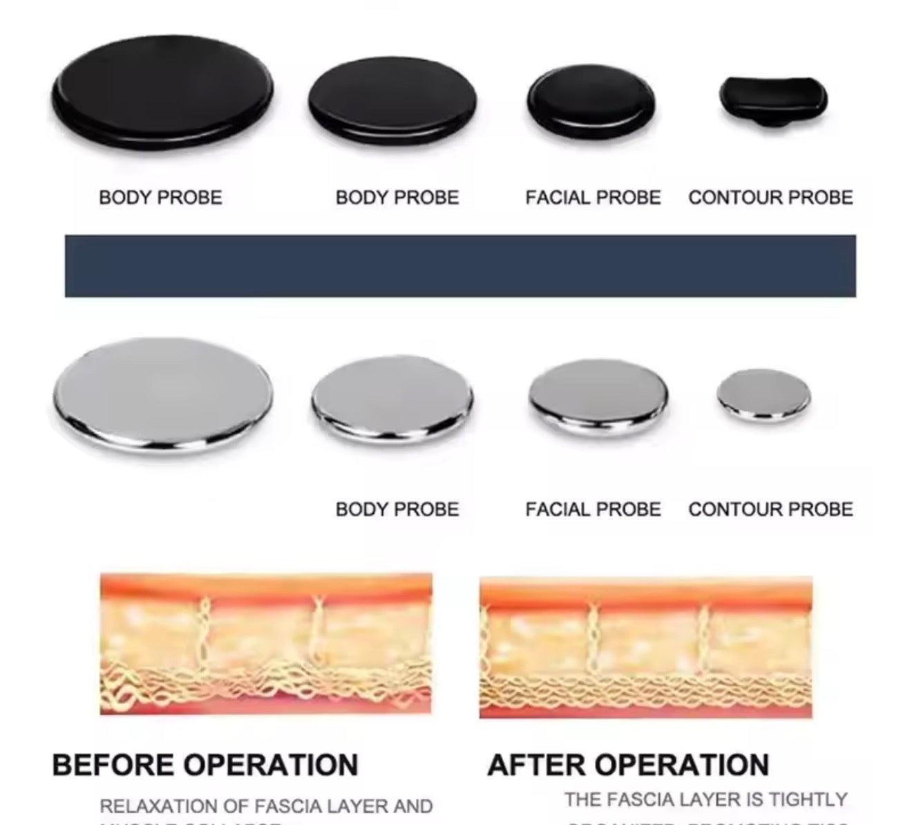 Lo mas nuevo adelgazamiento corporal Tecar 448k, estiramiento de la piel, antiarrugas equipo facial