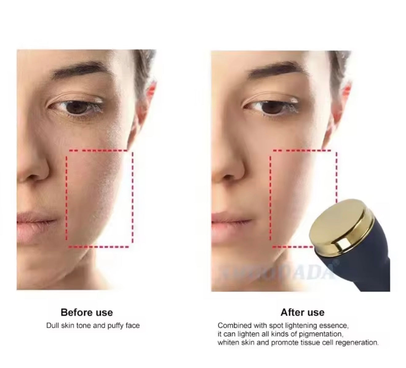 Máquina Facial ultrasónica 3 en 1 para eliminación de manchas, Facial antienvejecimiento,