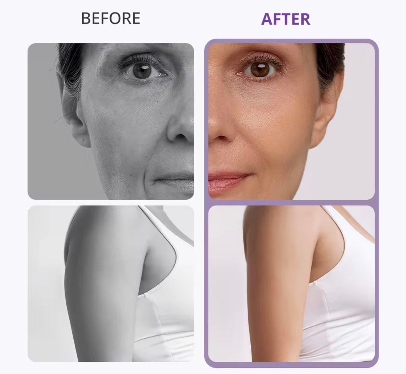 cavitación 8 en 1, máquina de adelgazamiento láser Lipo multifuncional para esculpir el cuerpo, radiofrecuencia 40K