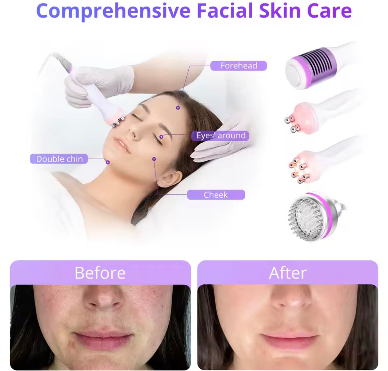 Máquina de cavitación aristorm 40k, 9 en 1,