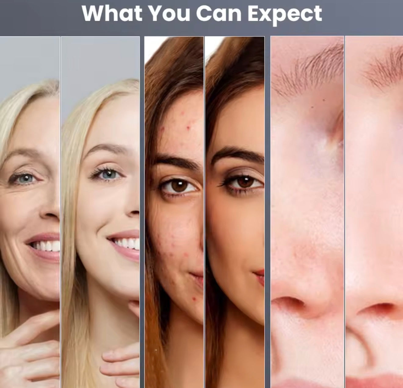 Máquina de hidrodermoabrasión 3 en 1,