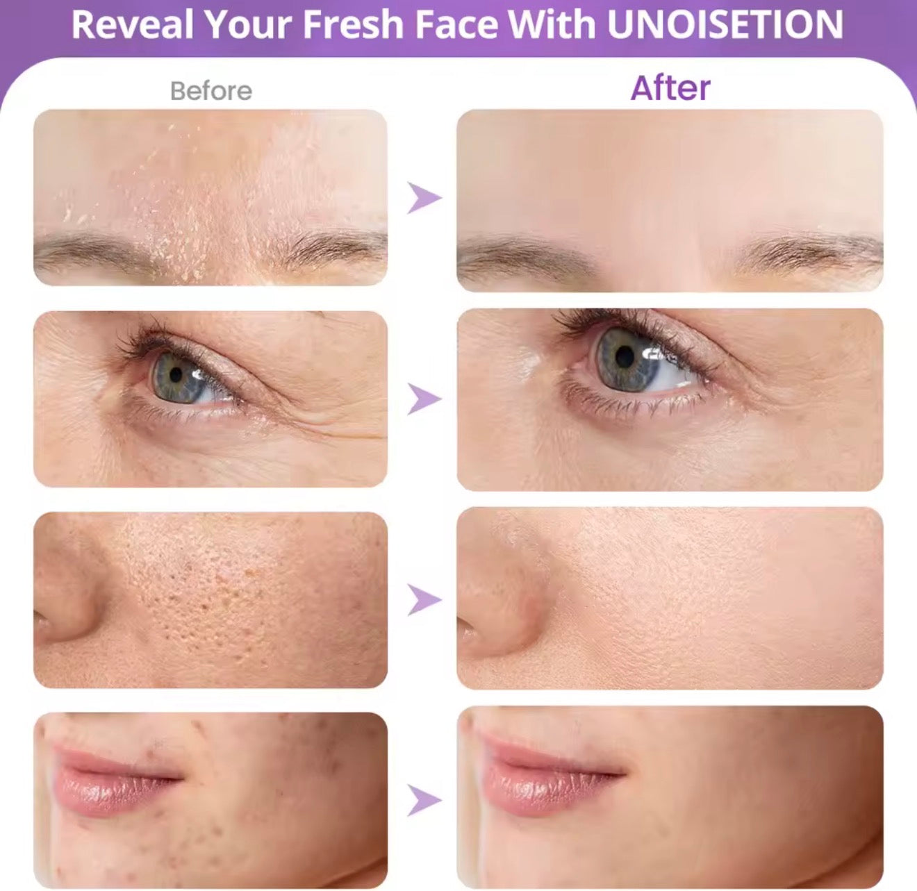 eliminador de espinillas eléctrico