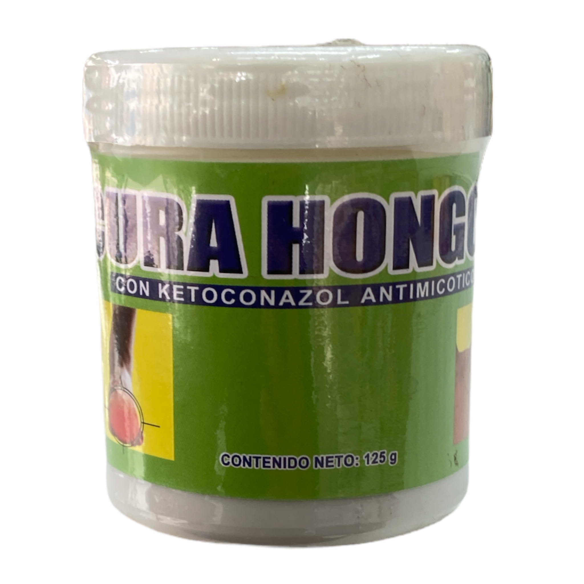POMADA CURA HONGOS 120  GR NATURALMEX