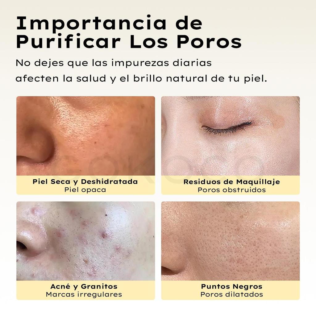 Limpiador de Poros por Vacío